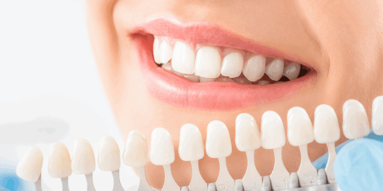 cuidado tras blanquimiento dental